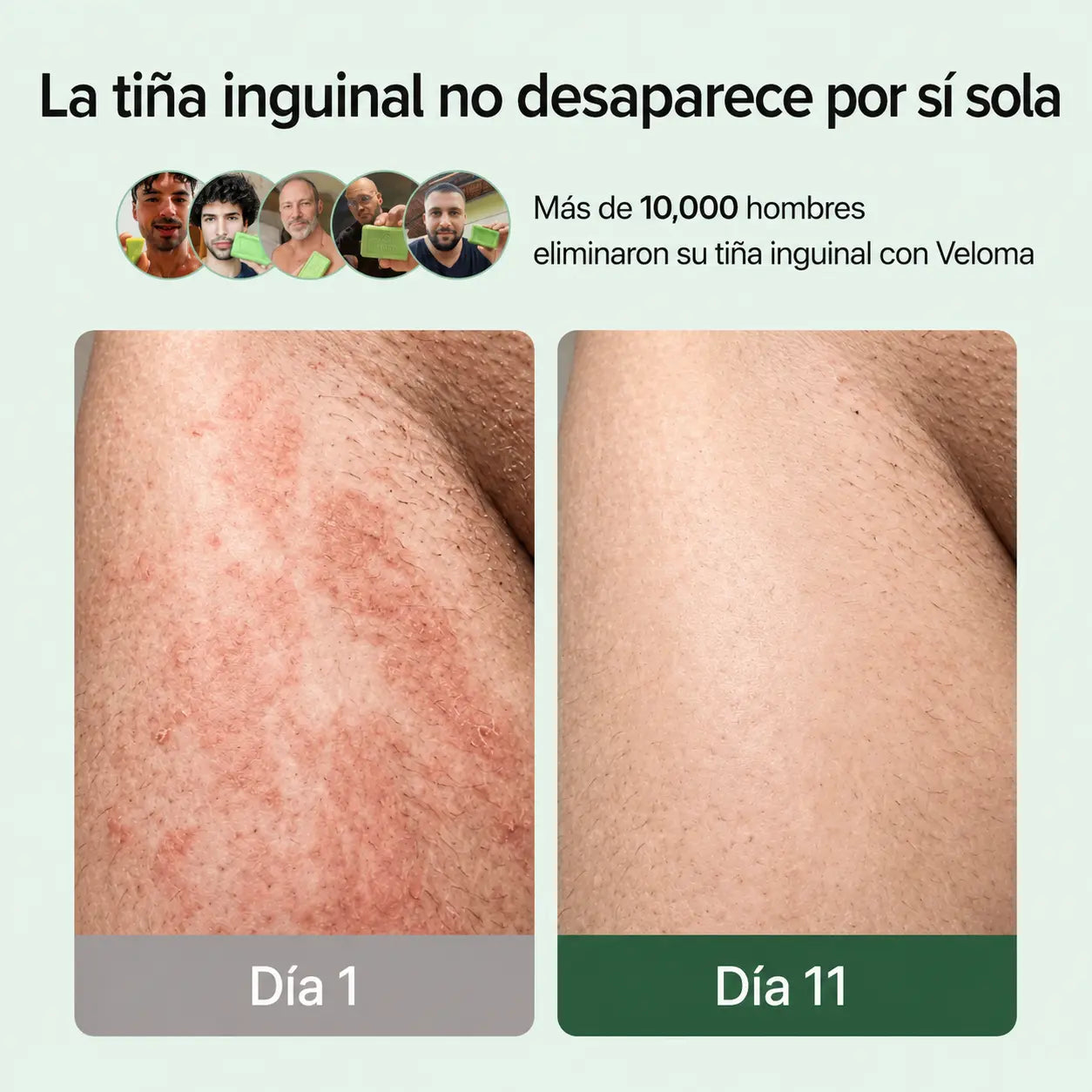 Veloma Jabón Antihongos