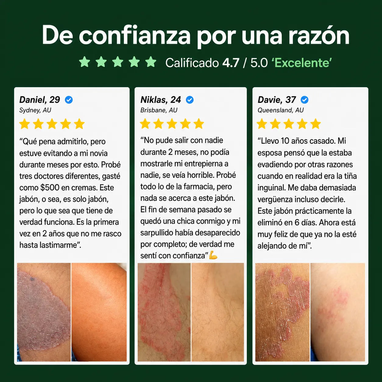 Veloma Jabón Antihongos