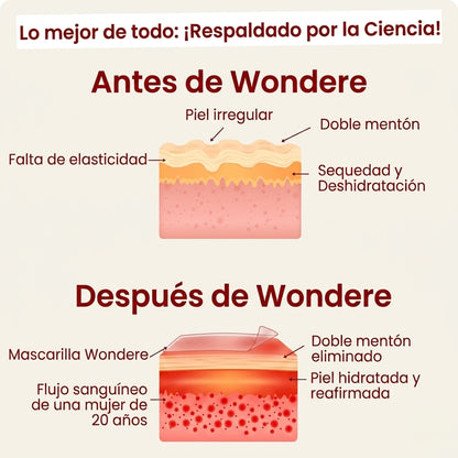 The Chinology Lift - reductor de papada