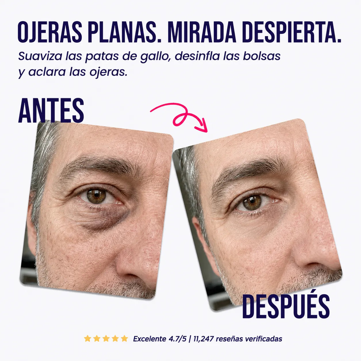 Parches de Microagujas para Ojeras y Bolsas