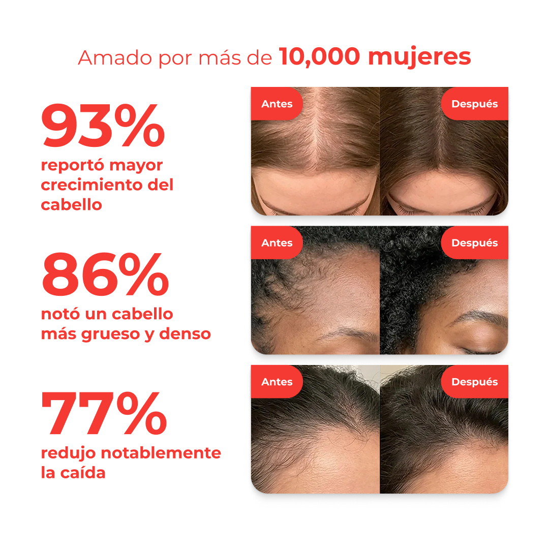 Korea's #1 Suero para el crecimiento del cabello.