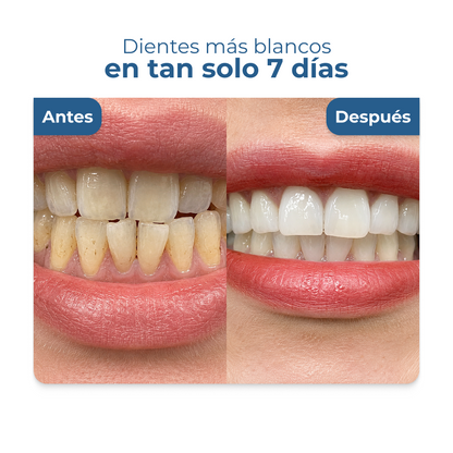 DentPerla