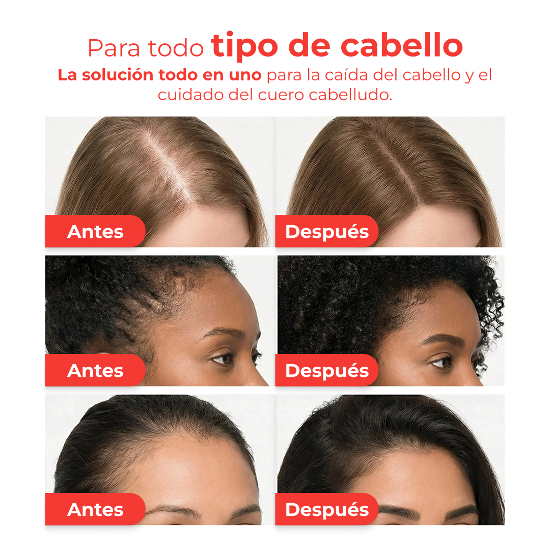 Korea's #1 Suero para el crecimiento del cabello.