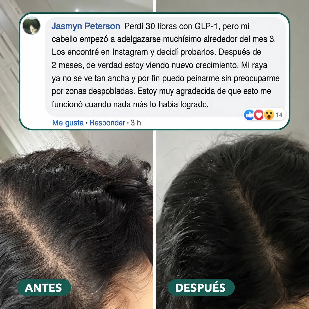 Gomas cabello fuerte